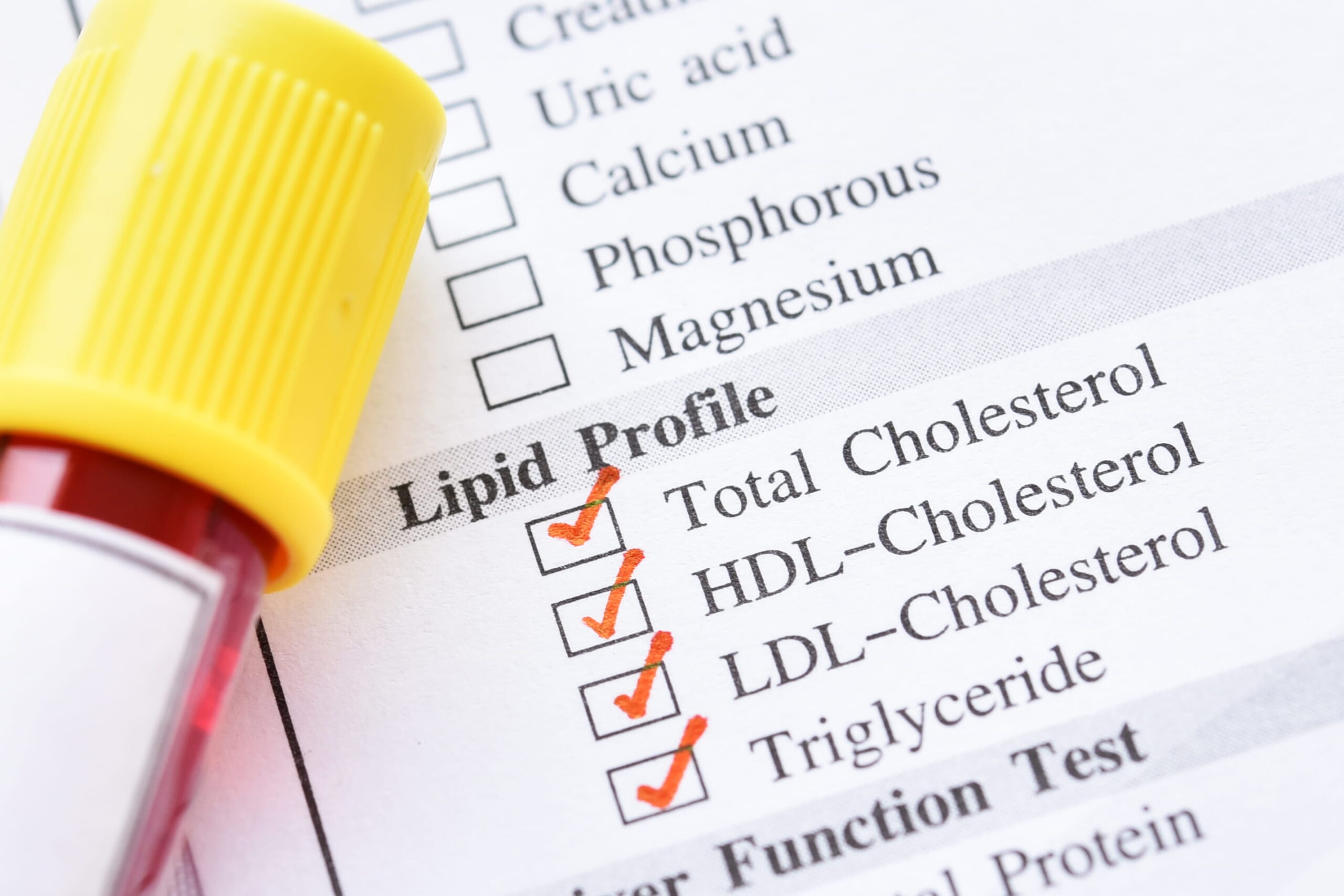 High Cholesterol & Nutrition